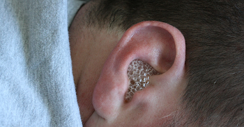 Ear Infection PNG Transparent Ear Infection.PNG Images. | PlusPNG