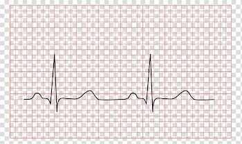 Electrocardiography QRS complex Medicine Cardiology Heart, electrocardiogram transparent background PNG clipart