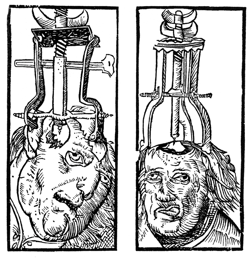 Engraving by Peter Treveris of a trepanation. | Free PNG - rawpixel