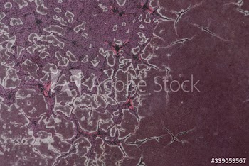 Eroded metal surface