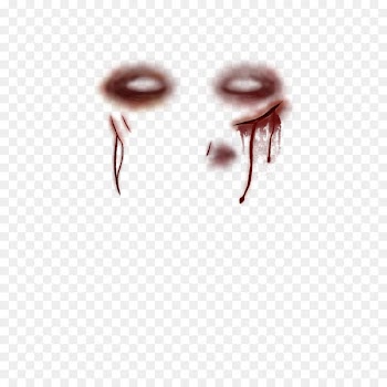 Face Bruise - scratches 
