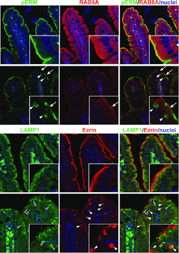 Fig. S3. pERM-positive inclusions are not associated with Rab8a ...