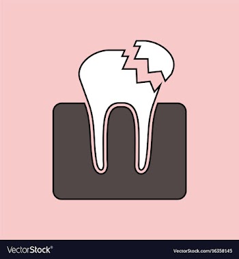 Flat icon design collection broken tooth vector image