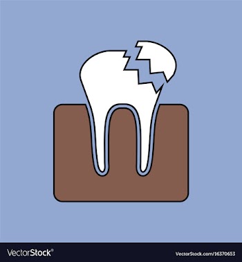 Flat icon design collection broken tooth vector image