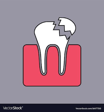 Flat icon design collection broken tooth vector image