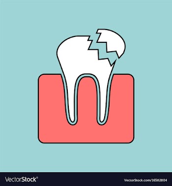 Flat icon design collection broken tooth vector image