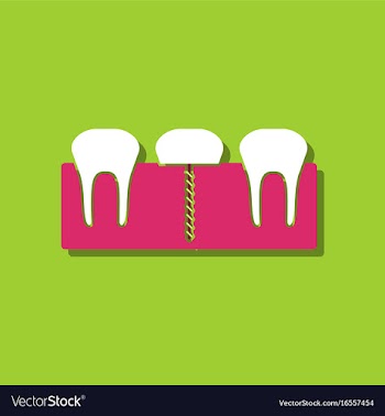 Flat icon design collection teeth and gum in vector image