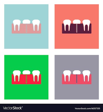 Flat icon design collection teeth and gum vector image