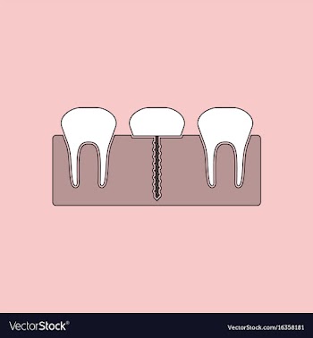 Flat icon design collection teeth and gum vector image