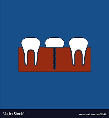 Flat icon design collection teeth and gum vector image