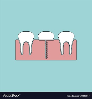 Flat icon design collection teeth and gum vector image