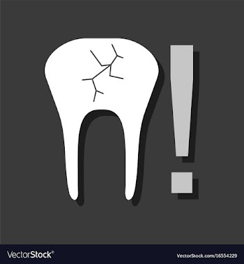 Flat icon design collection tooth fracture in vector image