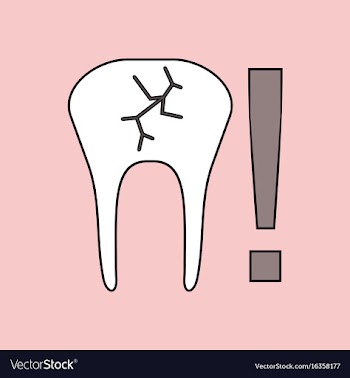 Flat icon design collection tooth fracture vector image