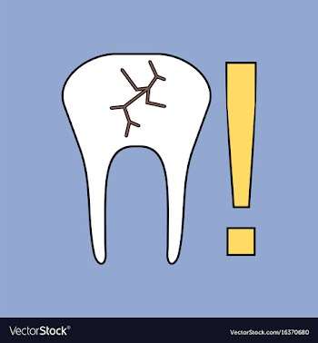 Flat icon design collection tooth fracture vector image