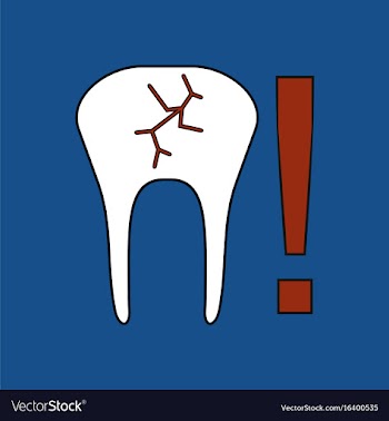Flat icon design collection tooth fracture vector image