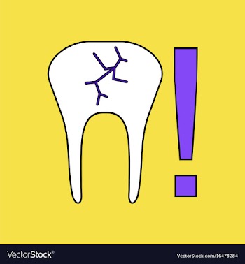 Flat icon design collection tooth fracture vector image