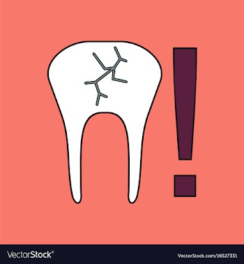 Flat icon design collection tooth fracture vector image
