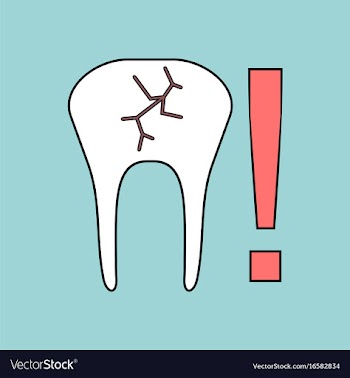 Flat icon design collection tooth fracture vector image