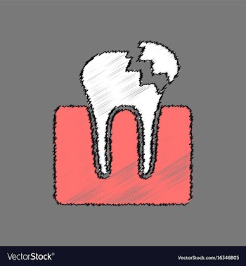 Flat shading style icon broken tooth vector image