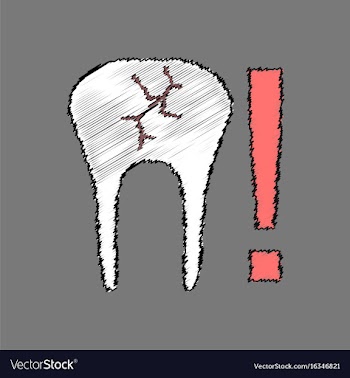 Flat shading style icon tooth fracture vector image