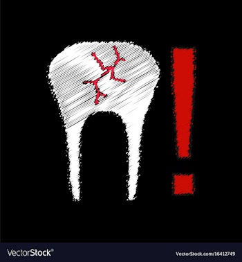 Flat shading style icon tooth fracture vector image