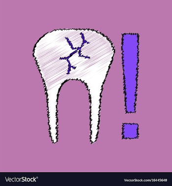 Flat shading style icon tooth fracture vector image