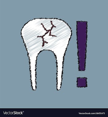 Flat shading style icon tooth fracture vector image