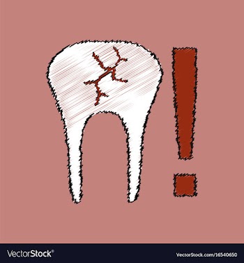 Flat shading style icon tooth fracture vector image
