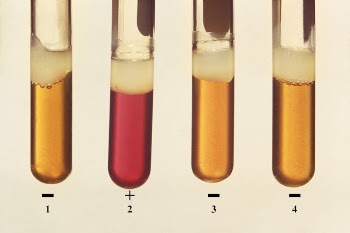 Four test tubes of bacterial | Free Photo - rawpixel