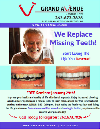 FREE Implant Seminar! — Grand Avenue Dental Care