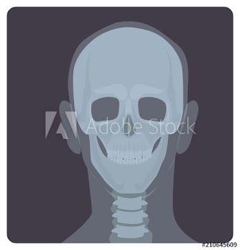 Frontal radiograph of skull