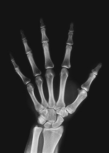 Hand CT scan collage element | Free PSD - rawpixel
