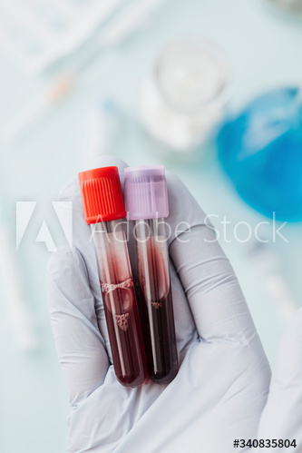 Hand of doctor holding blood test tubes during covid-19 outbreak