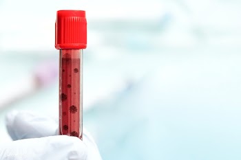 Hand wearing a glove holding a blood test tube | Free  photo - 2307031