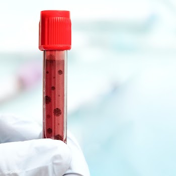 Hand wearing a glove holding a blood test tube | Free  photo - 2307032