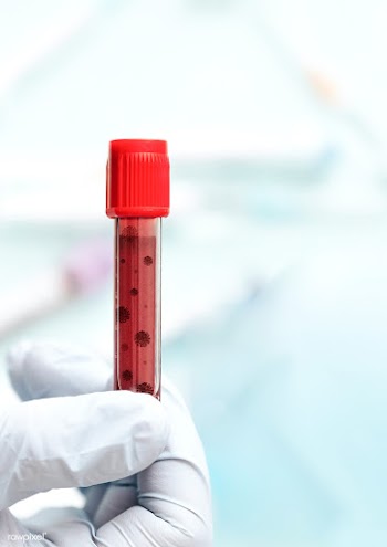 Hand wearing a glove holding a blood test tube | Free  photo - 2307033