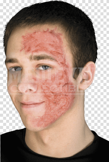 HD Burn Scar Face , Free Unlimited Download #414132 - Sccpre.cat