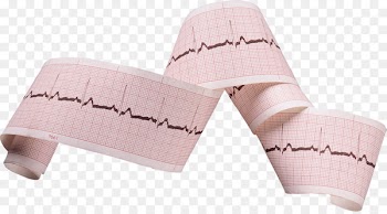 Heart arrhythmia Left ventricle Human heart - heart beat 