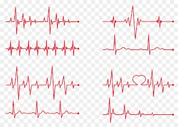 Heart rate Electrocardiography Clip art - ECG red line Creative 