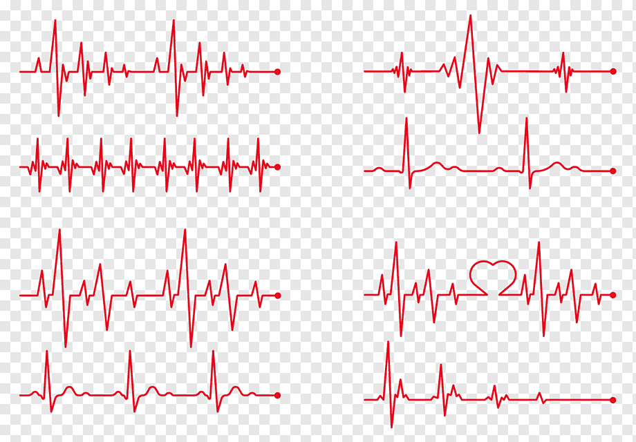 Heart rate Electrocardiography, red heart beat, lifeline illustration, angle, text, rectangle png