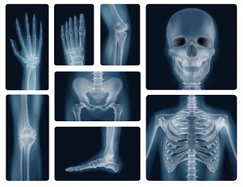 Human bones realistic x-ray shots Free Vector