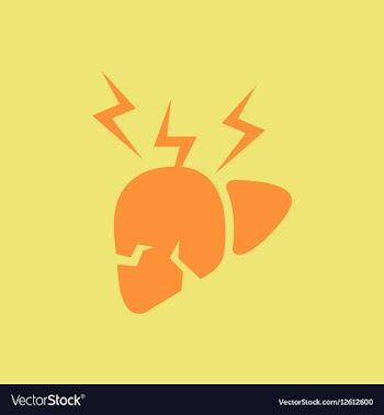 Human organ liver various symptoms of Malaria on vector image