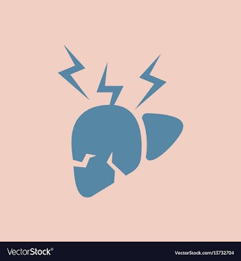 Human organ liver various symptoms of malaria on vector image