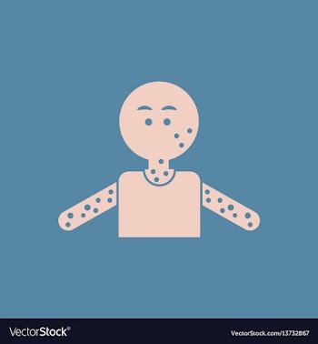 Human showered allergy various symptoms of aids vector image