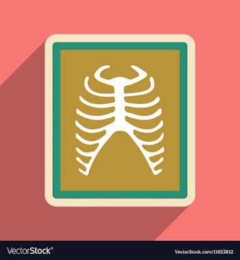 Icon of X-rays of ribs in flat style vector image
