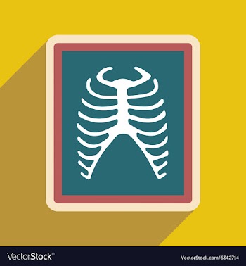 Icon of X-rays of ribs in flat style vector image