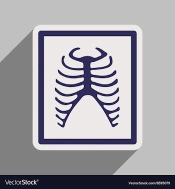 Icon of X-rays of ribs in flat style vector image