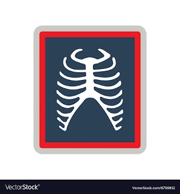 Icon of X-rays of ribs in flat style vector image
