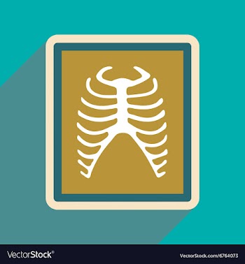 Icon of X-rays of ribs in flat style vector image