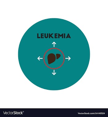 Icon on circle various symptoms of leukem vector image